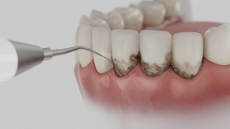 Trusted Teeth Whitening service in Durham, NC - Dentist Open Now